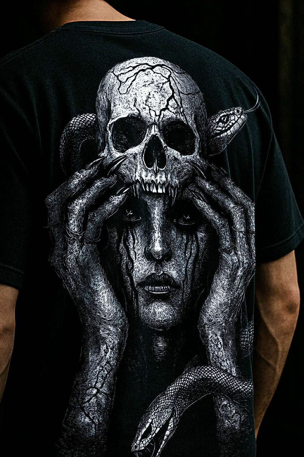 Mental - T-shirt